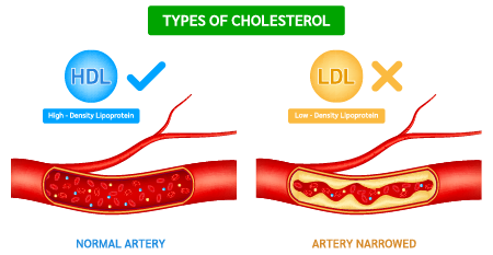 types of cholesterol 450