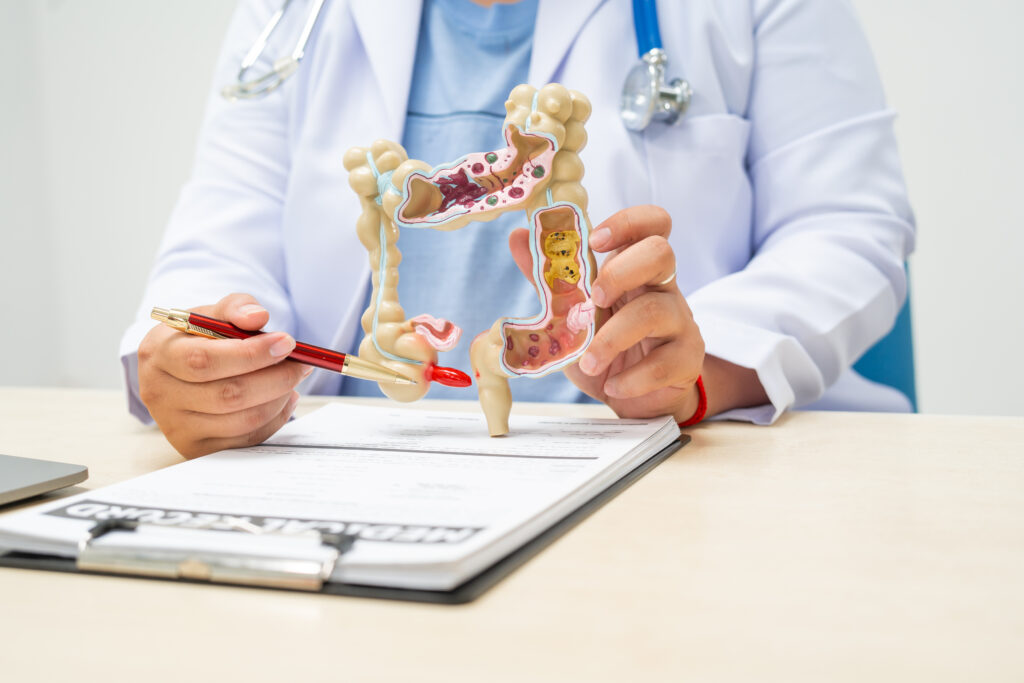 Colon Cancer Awareness Month (March 2024) 10 AdobeStock 956032928